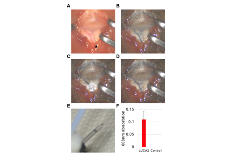 Evans blue measurements in cerebrospinal fluid panels and bar chart.